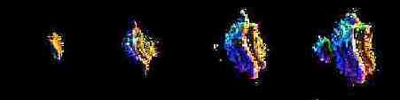 Cross sections through the 4D Bristor set